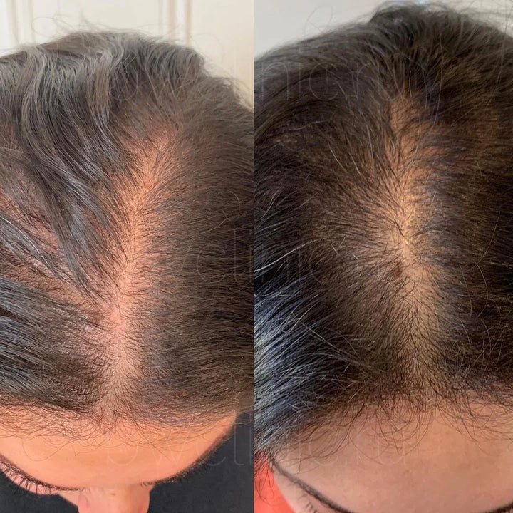 Hair Helper Spray - "Door dermatologen aanbevolen"