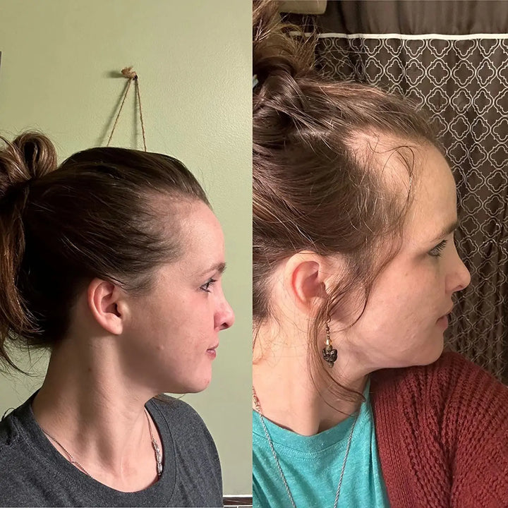 Hair Helper Spray - "Door dermatologen aanbevolen"