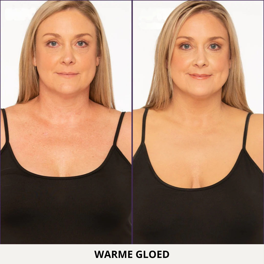 Nora Lichaamperfector