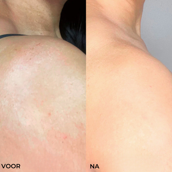 Glow Oli - Verstevigt en lift verslapte huid met 98%