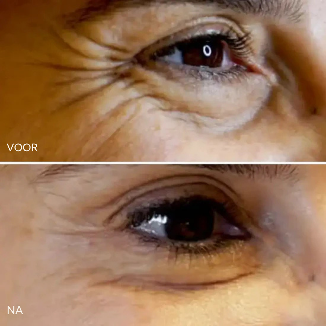 Nora Anti Age Stick - vermindert fijne lijntjes en oneffenheden direct