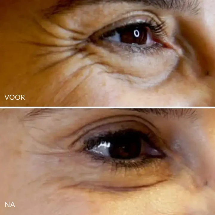 Nora Anti Age Stick - vermindert fijne lijntjes en oneffenheden direct